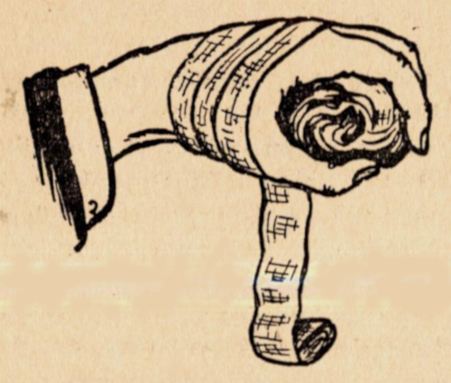 Так бинтуют руку при переломе кисти