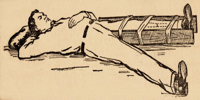 Наложение шины при переломе голени